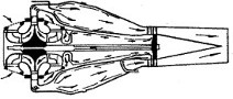 Radiális elrendezés